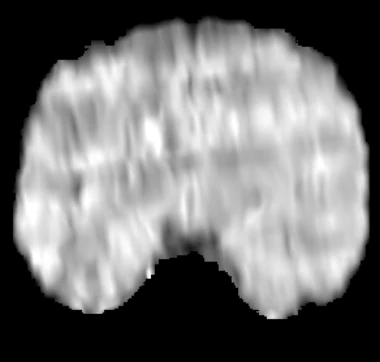 SynthSeg on the 0.1 T acquisition: no structures found